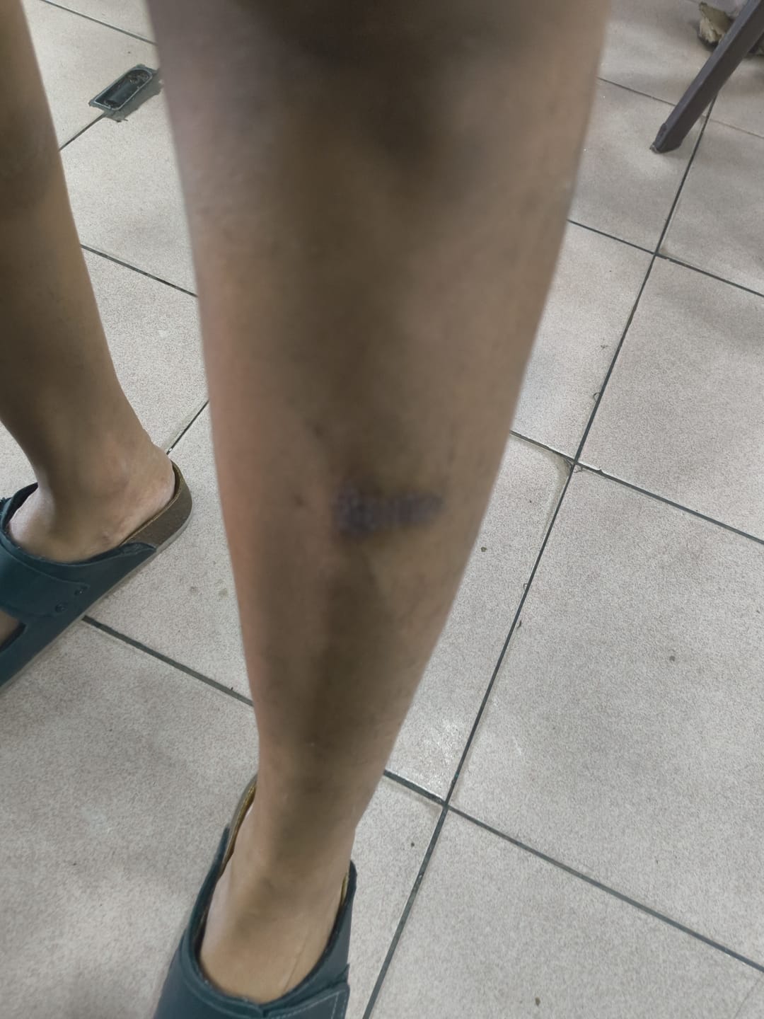 Customer photo review of Jolicare Cream