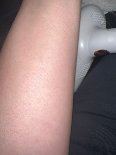 Customer photo review of Depilo IPL Max - Dauerhafte Haarentfernung
