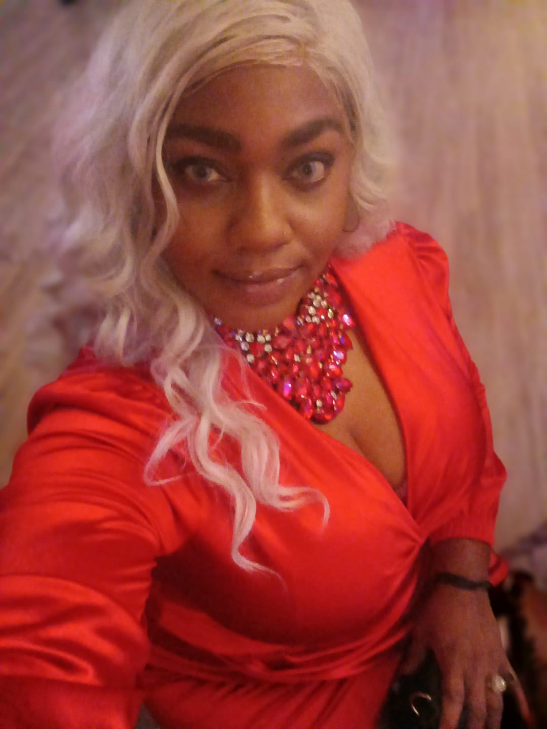 Customer photo review of FANTASY SNOW FLAKE Prescription Colored Contact Lenses