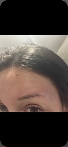 Customer photo review of BROWCOCA!NE - Augenbrauenserum