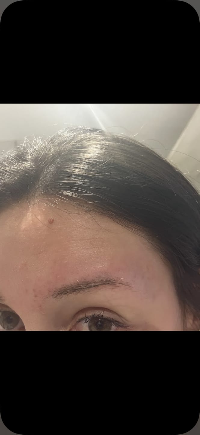 Customer photo review of BROWCOCA!NE - Augenbrauenserum