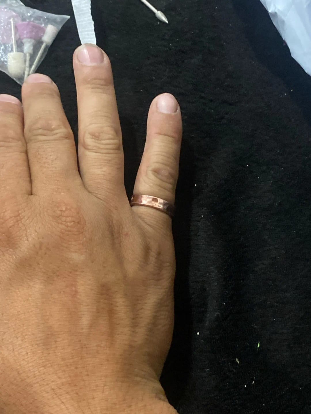 Customer photo review of Healing Ring