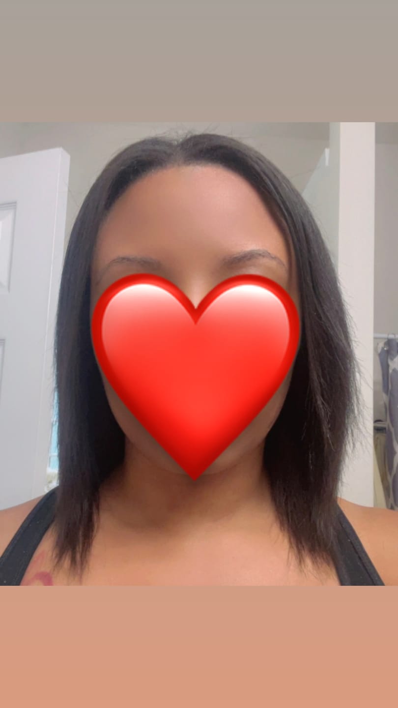 Apollonia A. Hairfinity Scalp Elixir customer photo