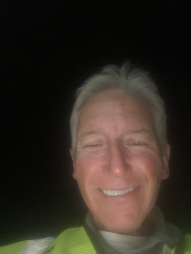 Customer photo review of Pop On Veneers - Custom Made Production