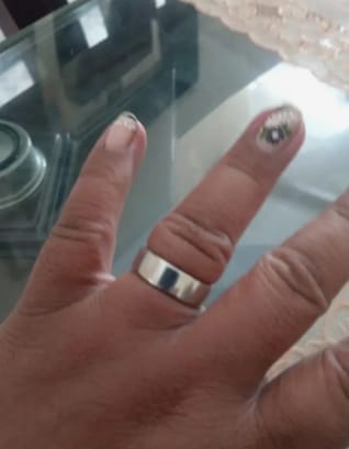 Customer photo review of Healing Ring