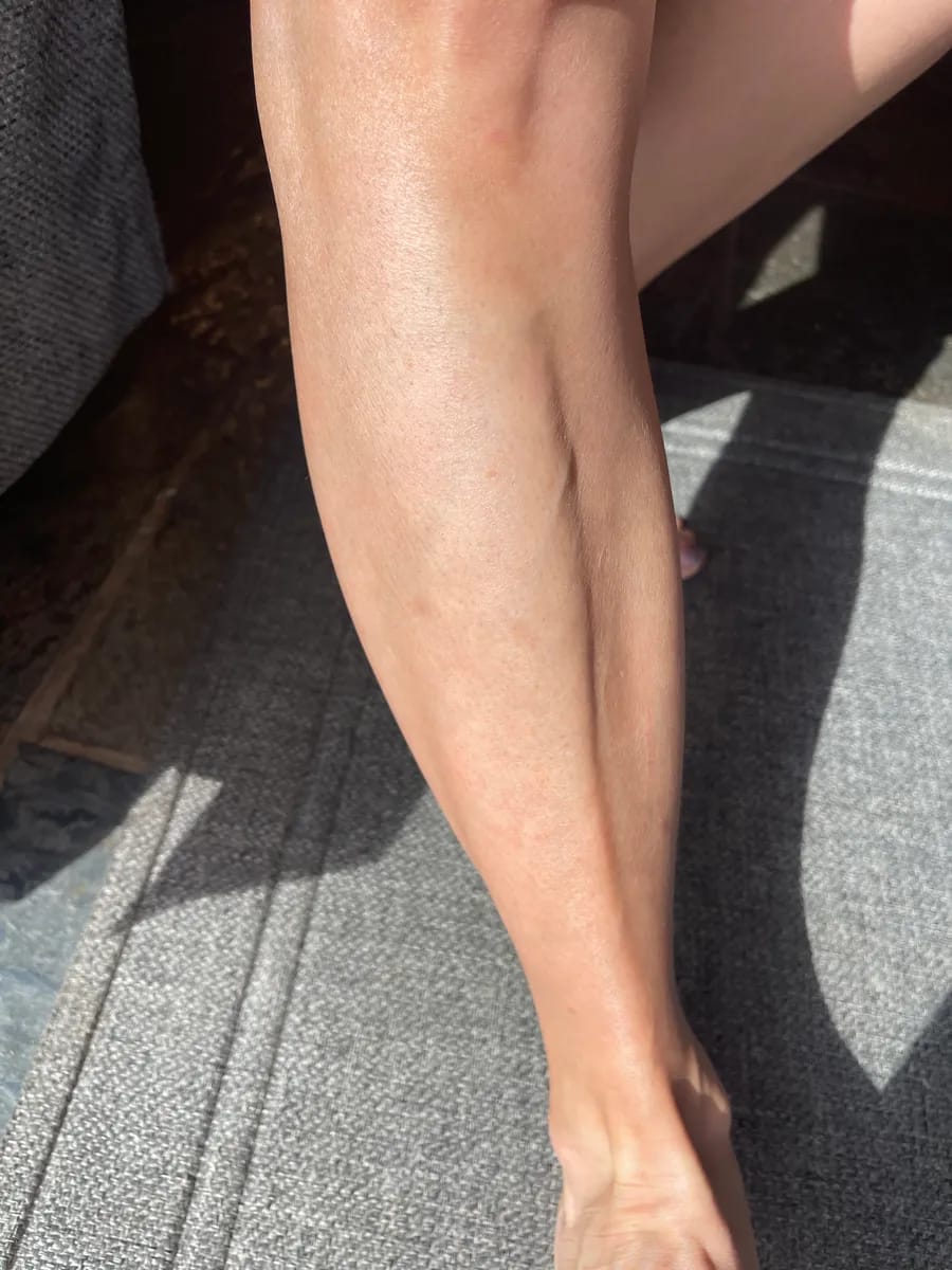 Customer photo review of SkinUp Pro