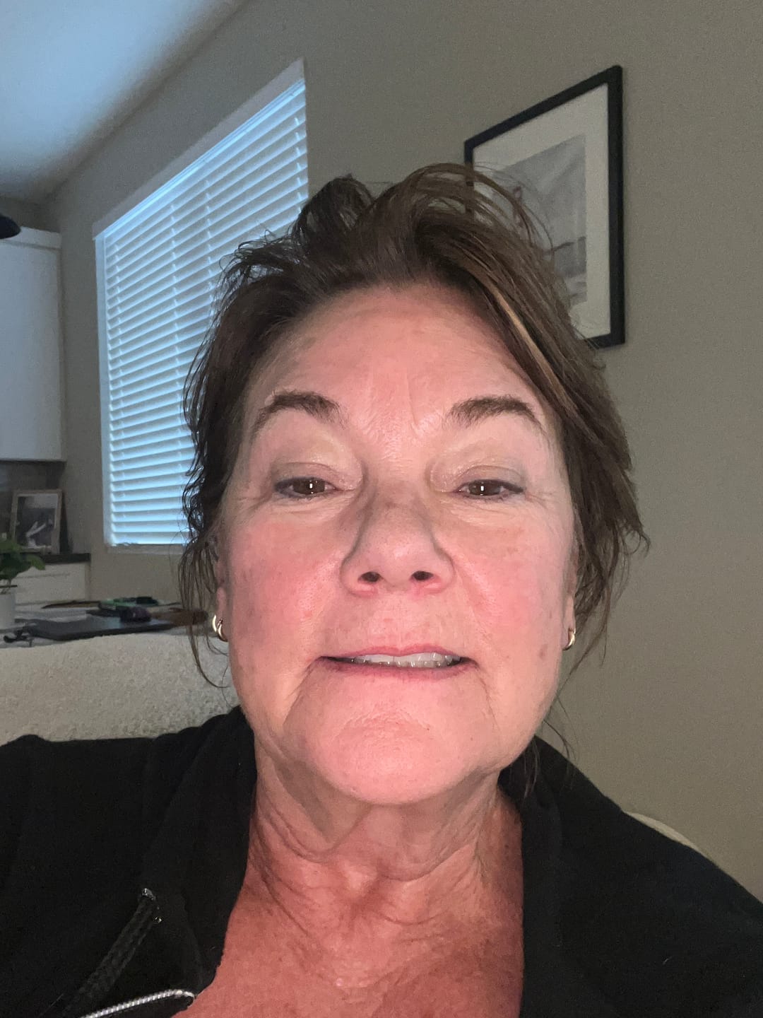 Customer photo review of F7 BRILLIANCE BOOST VITAMIN C+E+FERULIC ACID