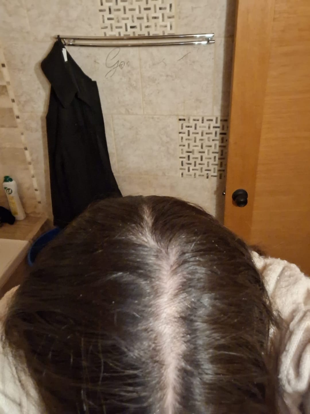 Customer photo review of Tónico Anticaída