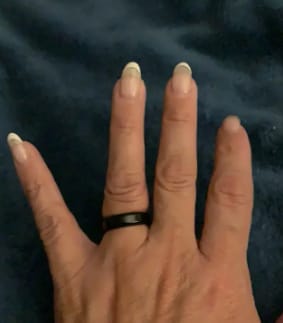 Customer photo review of Healing Ring
