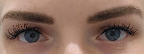 Customer photo review of THE CANCER (Krebs 5-11 mm)