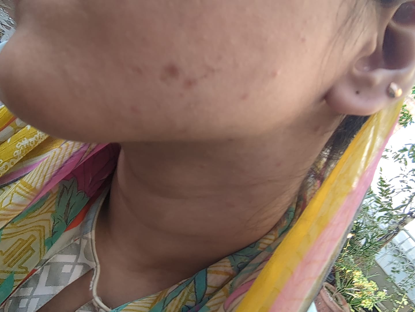 Customer photo review of Clear Skin Rescue