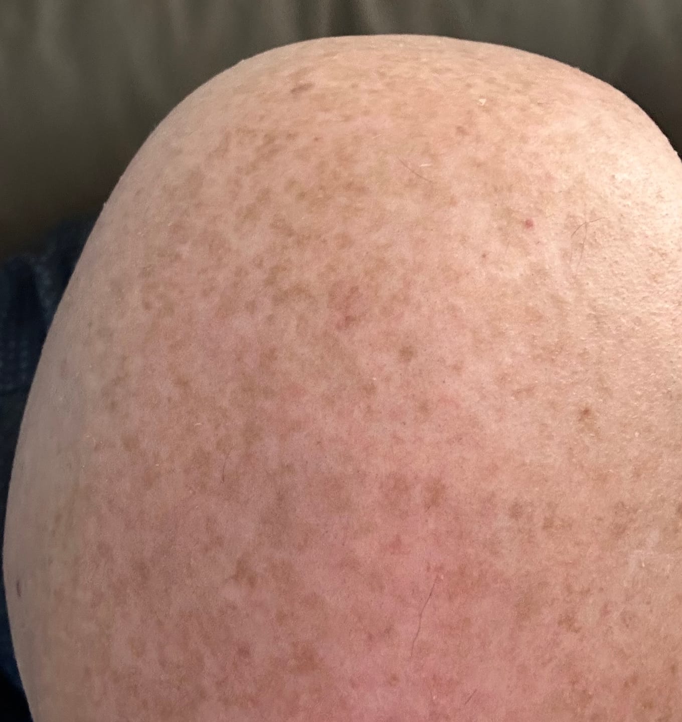 Customer photo review of Trimpod 3.0: The Ultimate Shaver for Bald Men