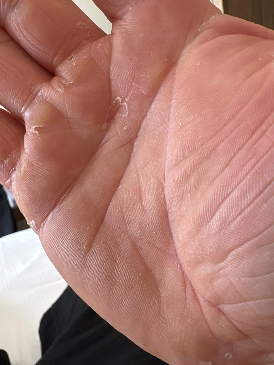 Customer photo review of Large Bioskin Duo Pack