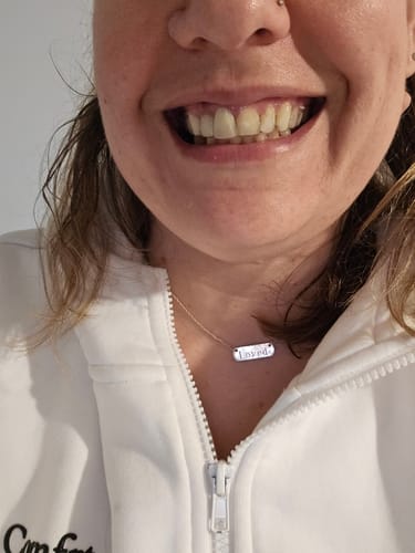 Customer photo review of Upper Partial Denture Retainer (1 Tooth Only)