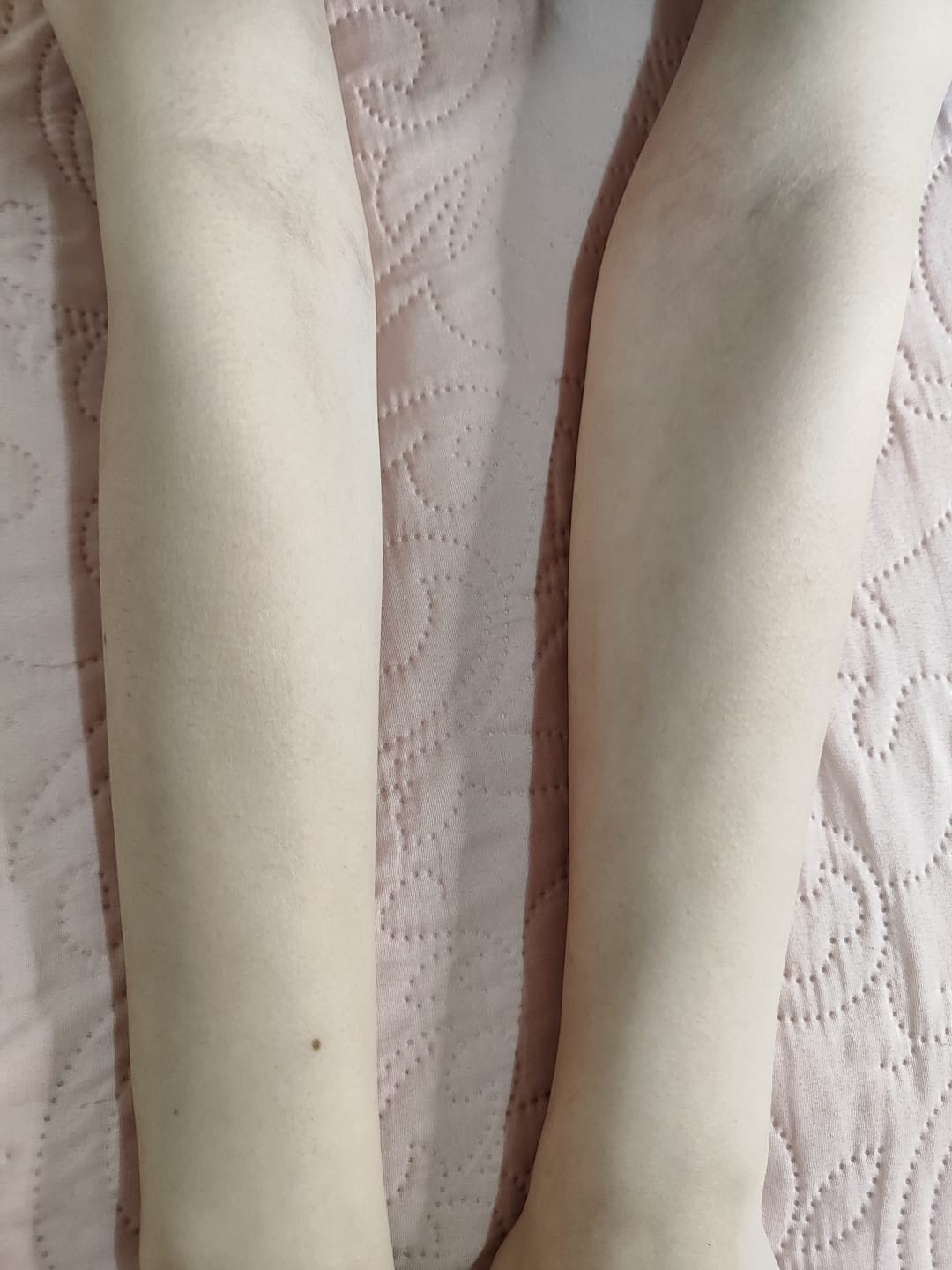 Customer photo review of SkinUp Pro