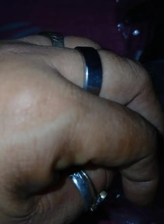 Customer photo review of Healing Ring