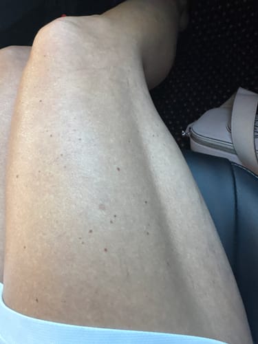 Customer photo review of Besque™ Magic Body Oil - 100ml