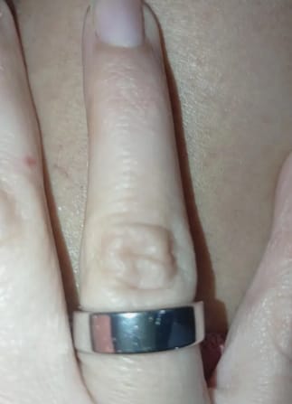 Customer photo review of Healing Ring