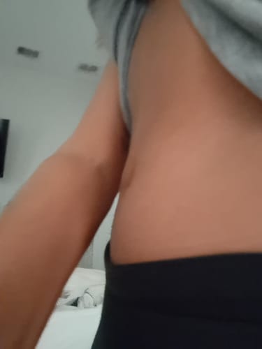 Customer photo review of Tirzepatide Weight Loss Program