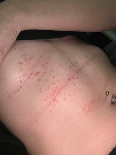 Customer photo review of Exfoli-YAY Body Wash