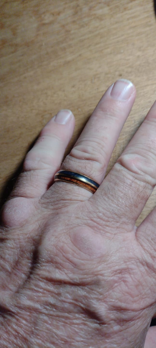 Customer photo review of The Golden Blue 6mm Wonder Ring