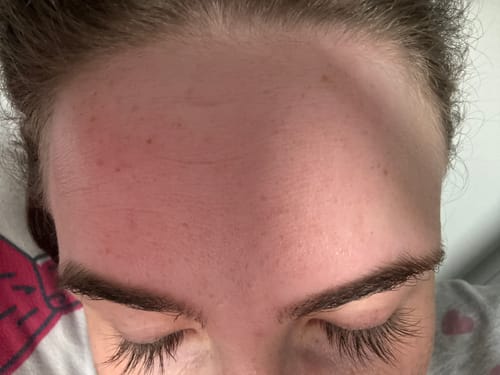 Customer photo review of LASHCOCA!NE - Wimpernserum