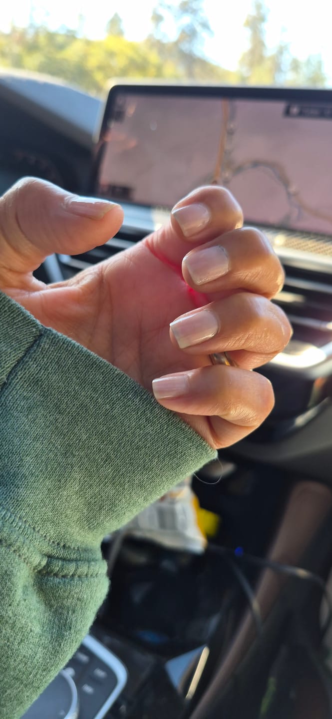 Customer photo review of Hair Skin and Nails Protocol