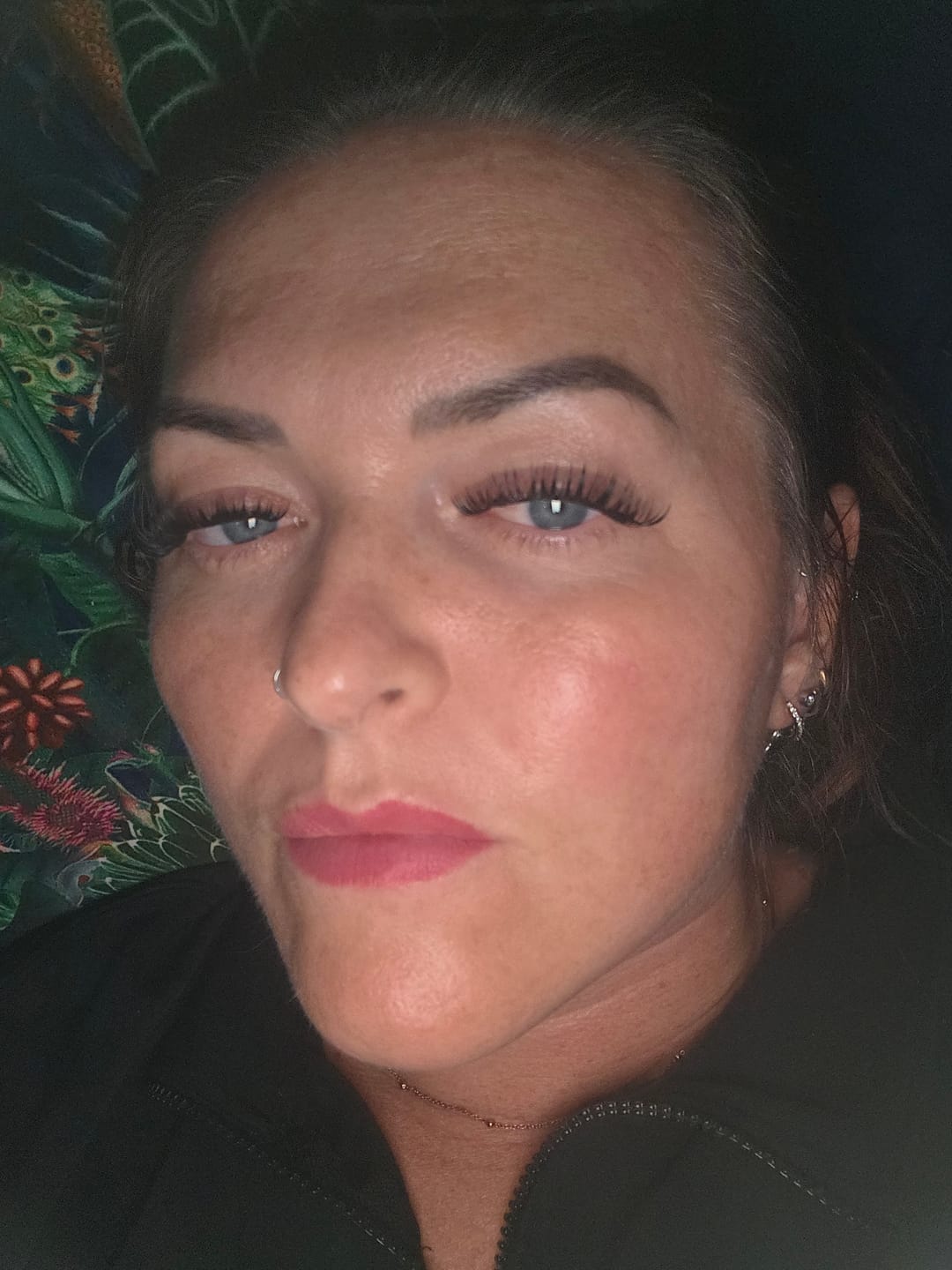 Customer photo review of 5-Step Clear Skin Kit