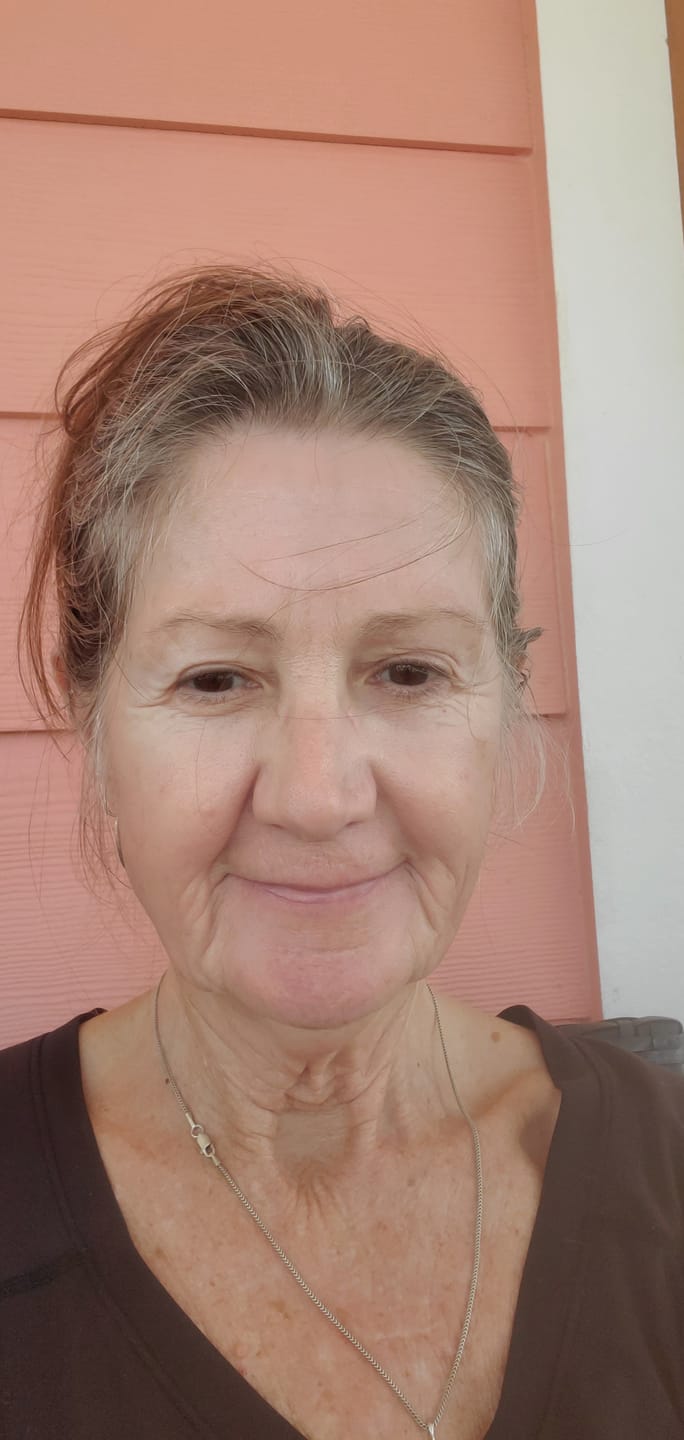 Customer photo review of 3 Month Supply - Seranova Micro Infusion System