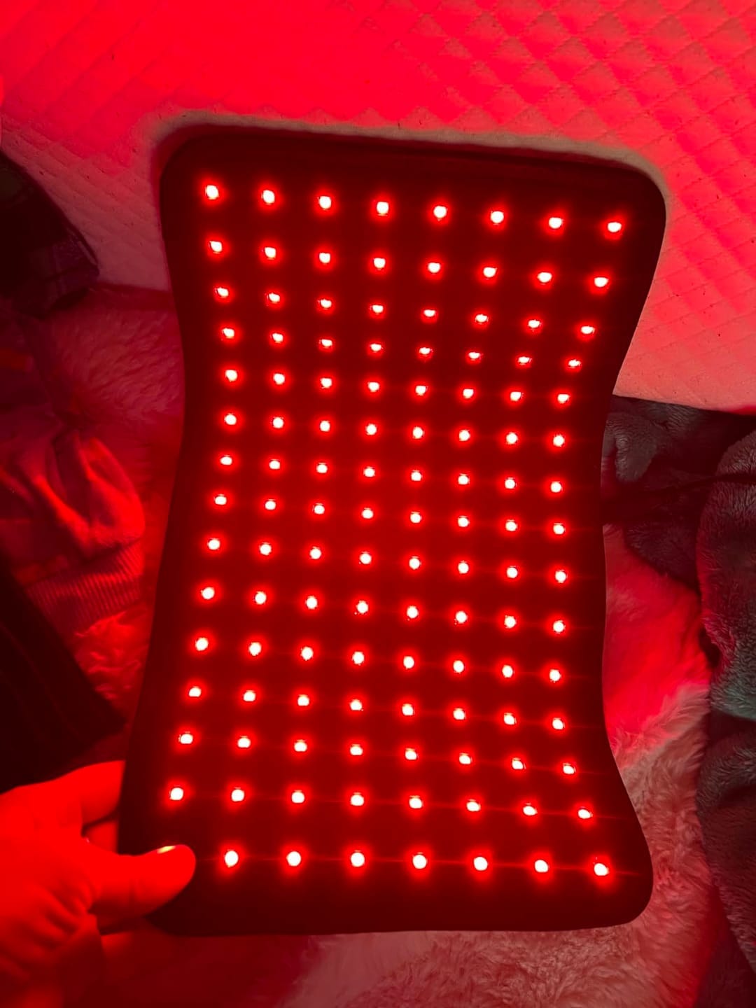 Customer photo review of Solasculp™ ContourBand – Arm & Thigh Red Light Therapy