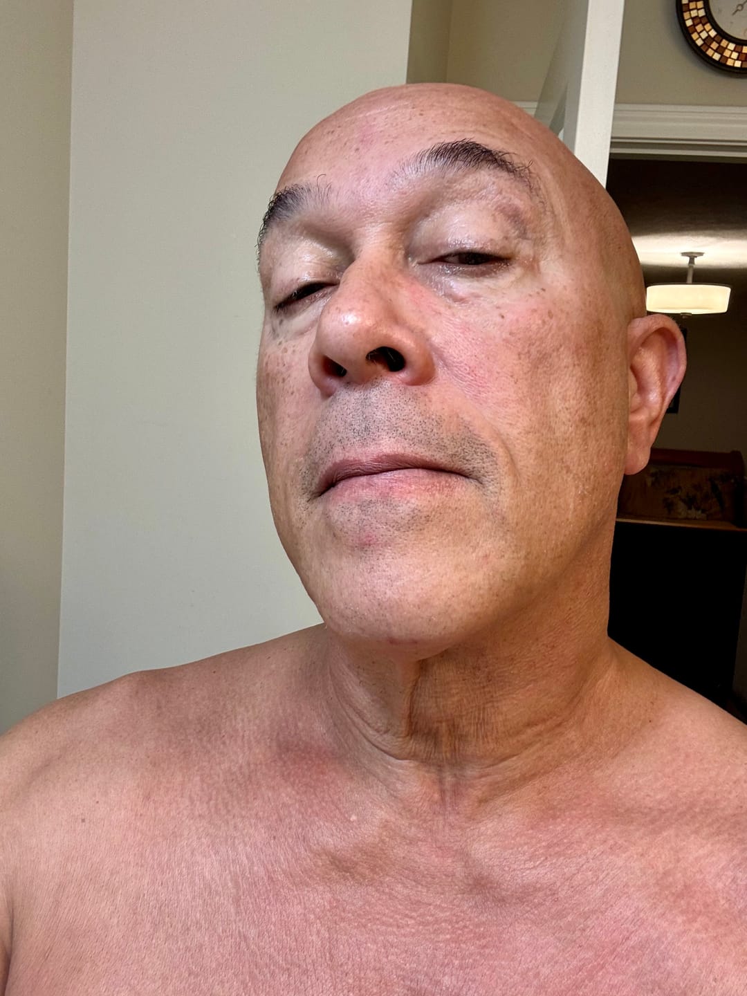 Customer photo review of Face & Neck Firming Duo