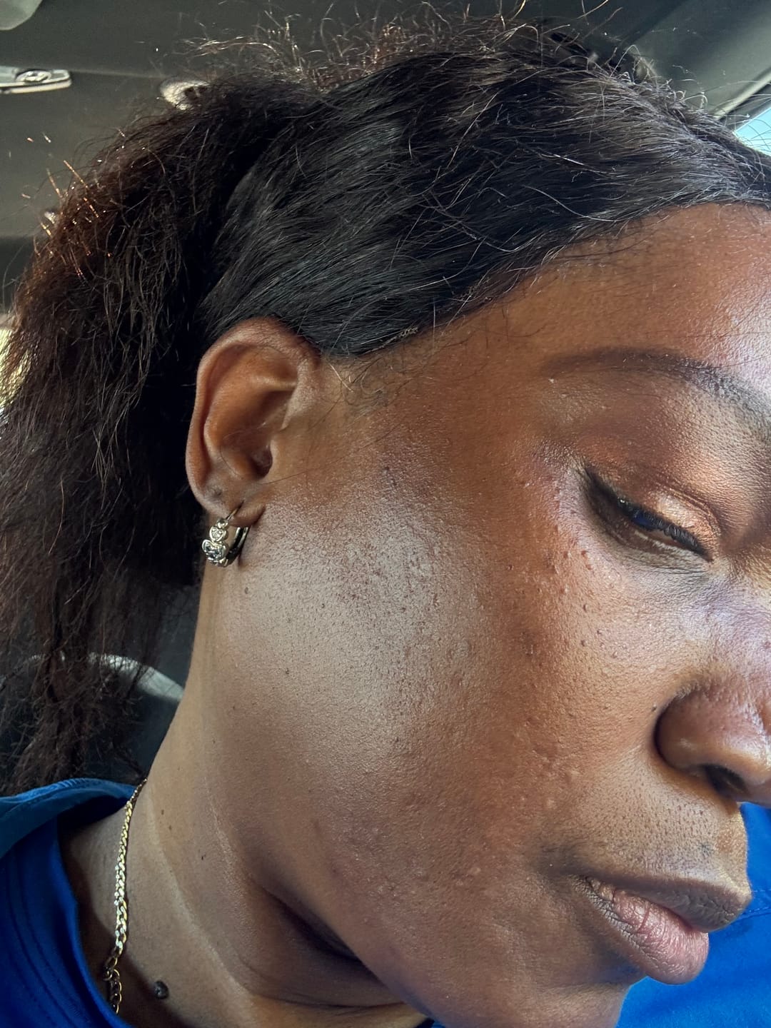 Customer photo review of Magic Eraser Dark Spot Cream