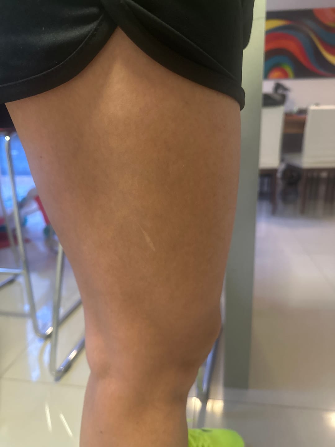 Customer photo review of Crema para Celulitis EMILY 200ml🧴🦵 con Centella y Vitamina E