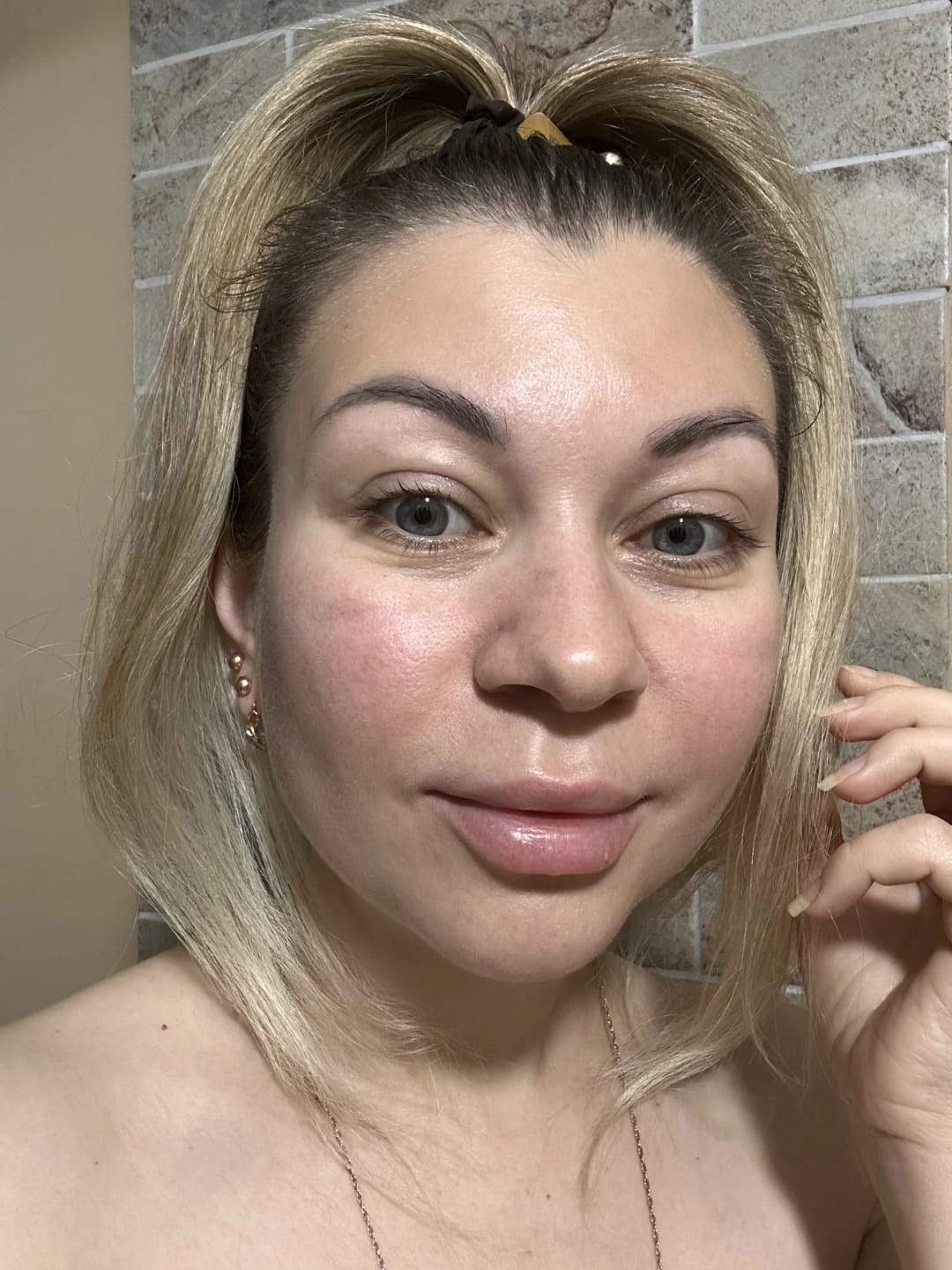 Customer photo review of The Micro-Infusion System by Rewindglow™