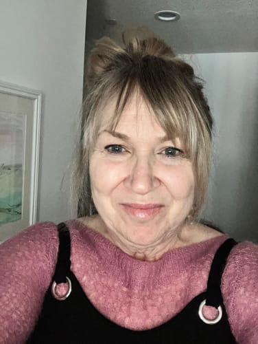 Customer photo review of 4 Glov Micro Infusion System + 12 Serums + 8 Needles