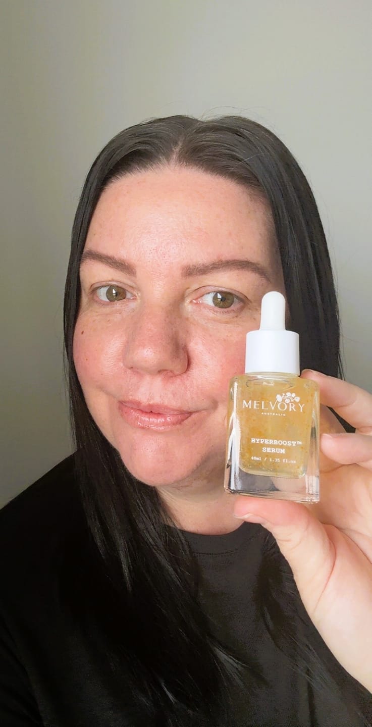 Customer photo review of Vitamin C 10% HYPERBOOST® Serum