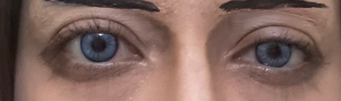 Customer photo review of Amaretto Blue Prescription Colored Contact Lenses