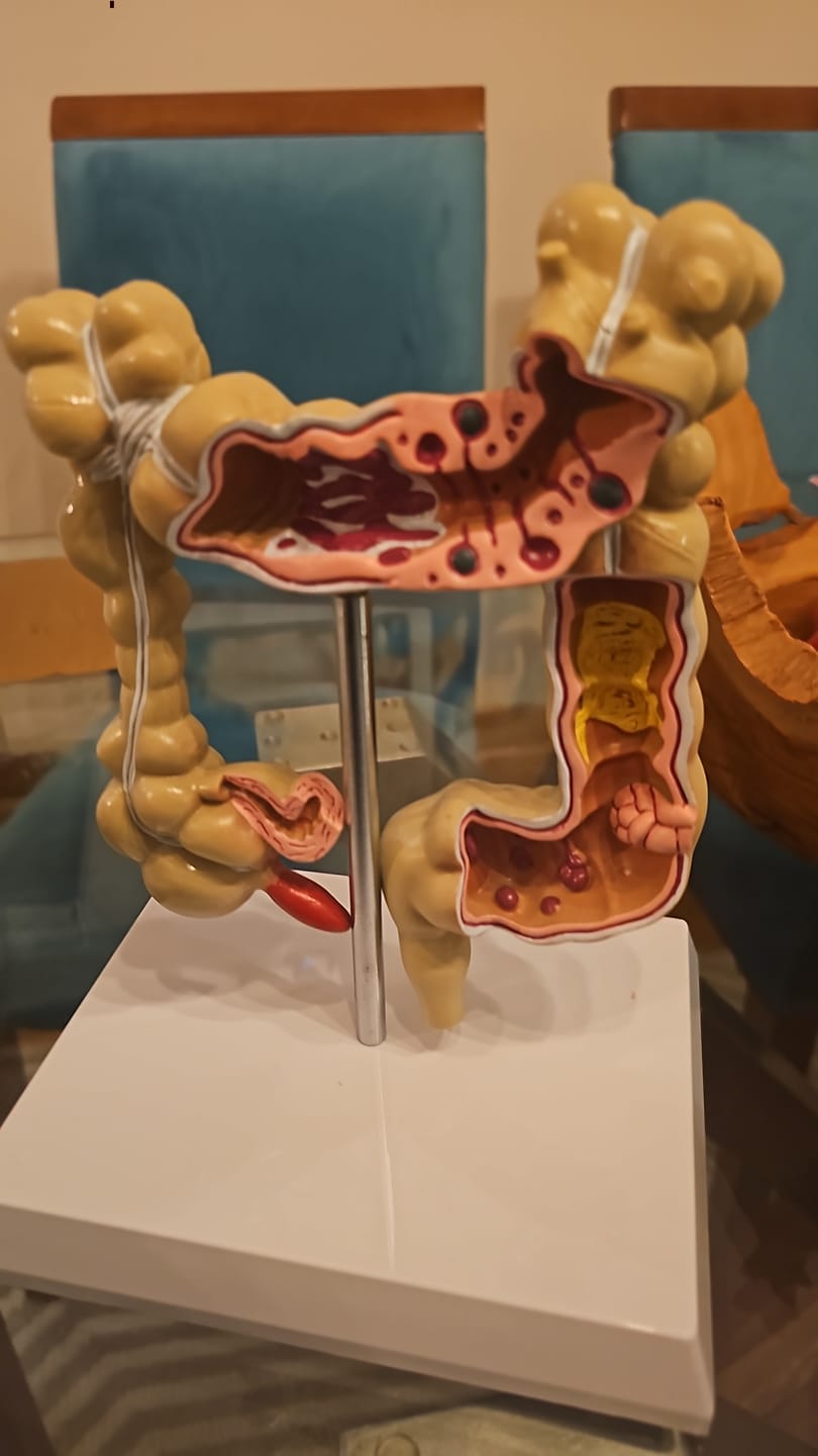 Customer photo review of Modelo Anatómico de Colon con Patologías Comunes