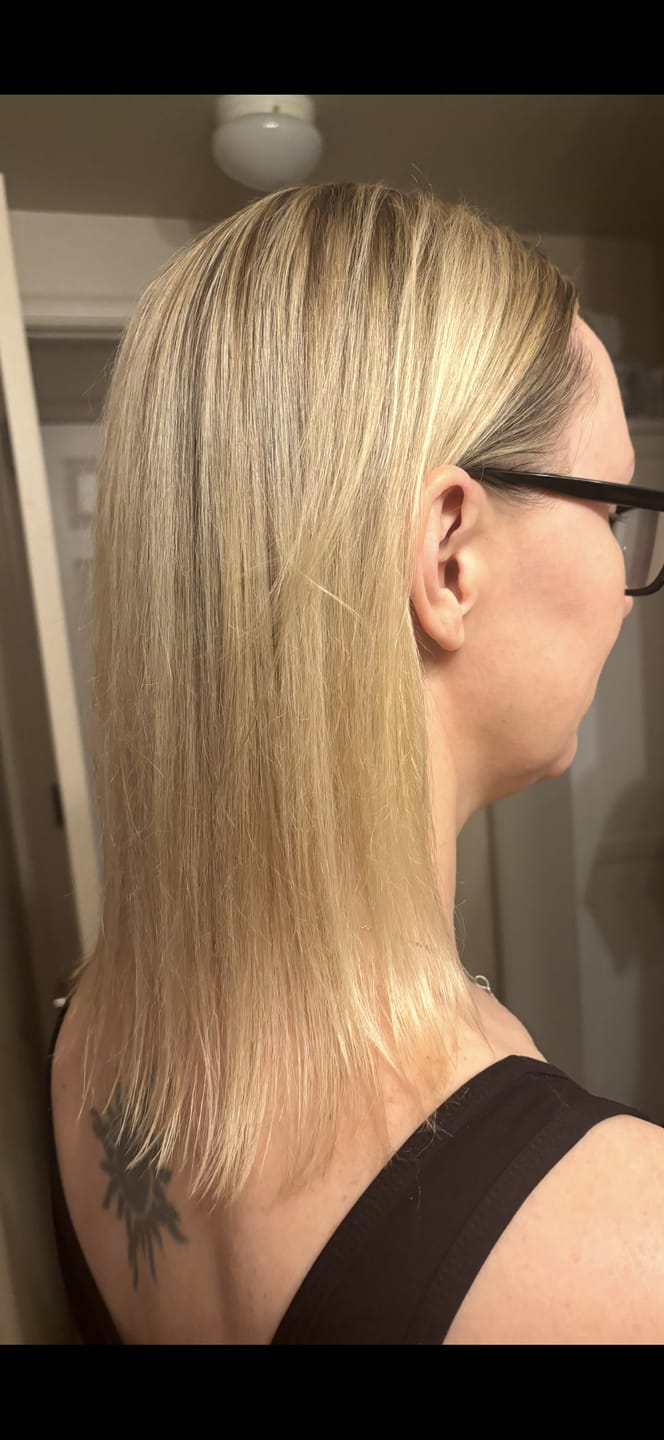Customer photo review of J+J | Natural Hair Growth Oil | Coconut Lime