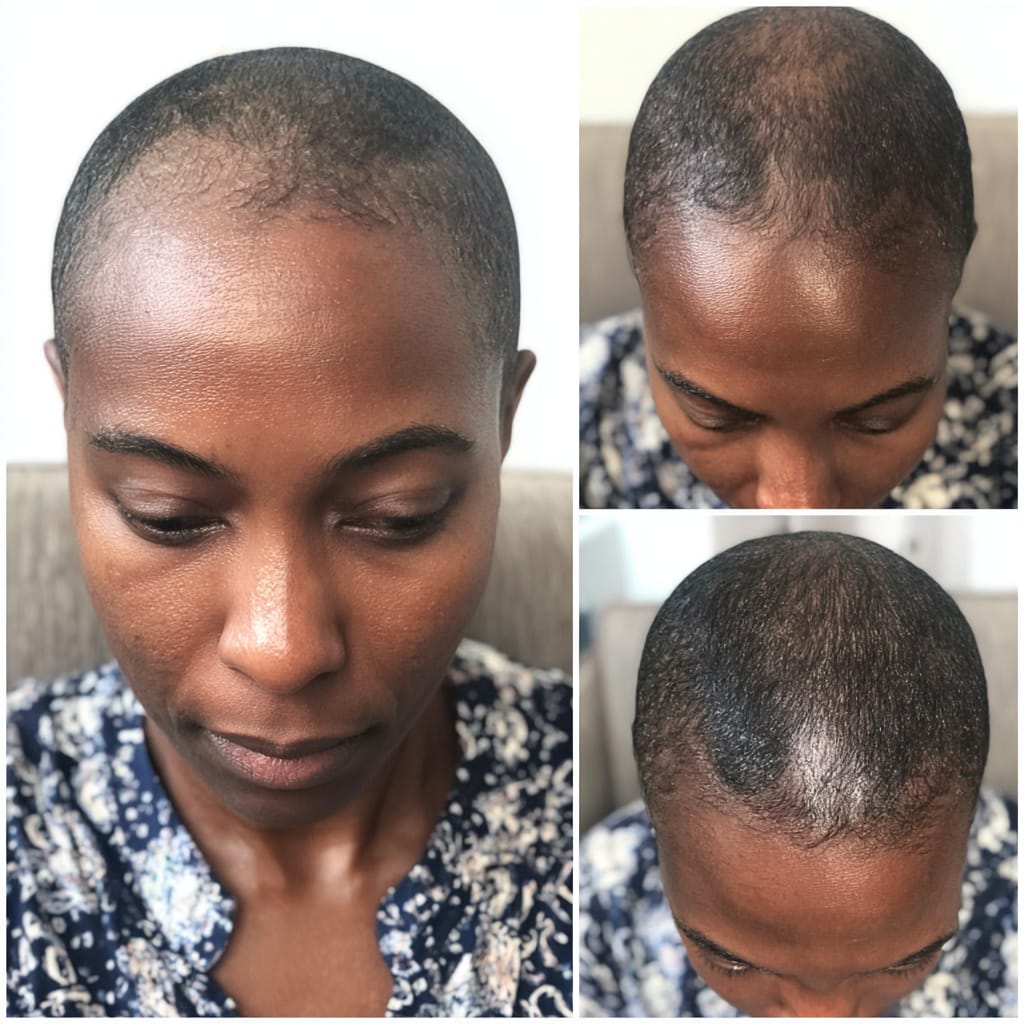 Customer photo review of Gashee Botanical Hair Serum - Rapunzel