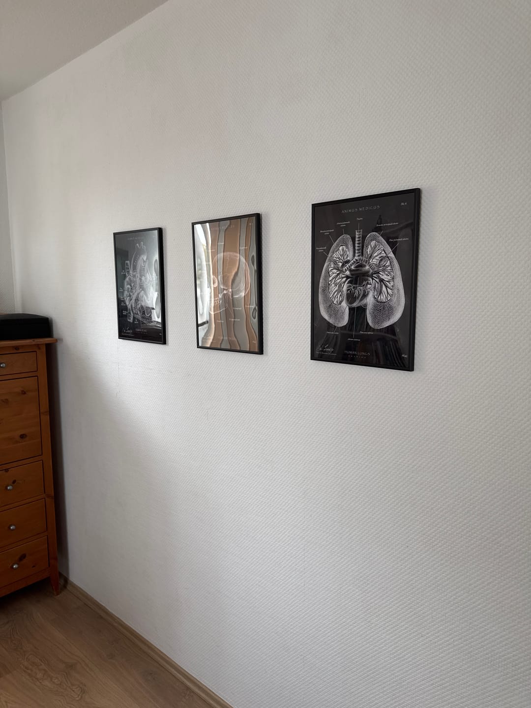 Customer photo review of Rücken Anatomie Sammlung