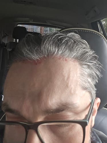 Customer photo review of Seb Natural Calming Serum