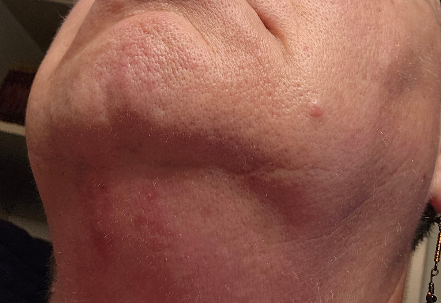 Customer photo review of Spot Treatment