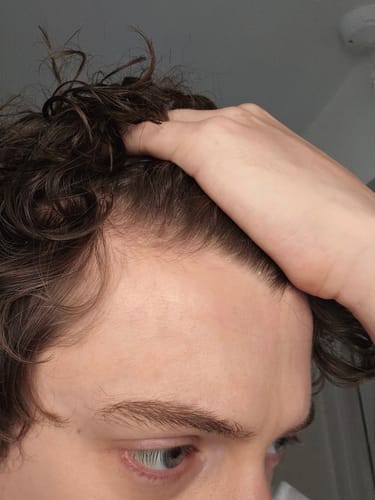 Customer photo review of Seb Natural Calming Serum