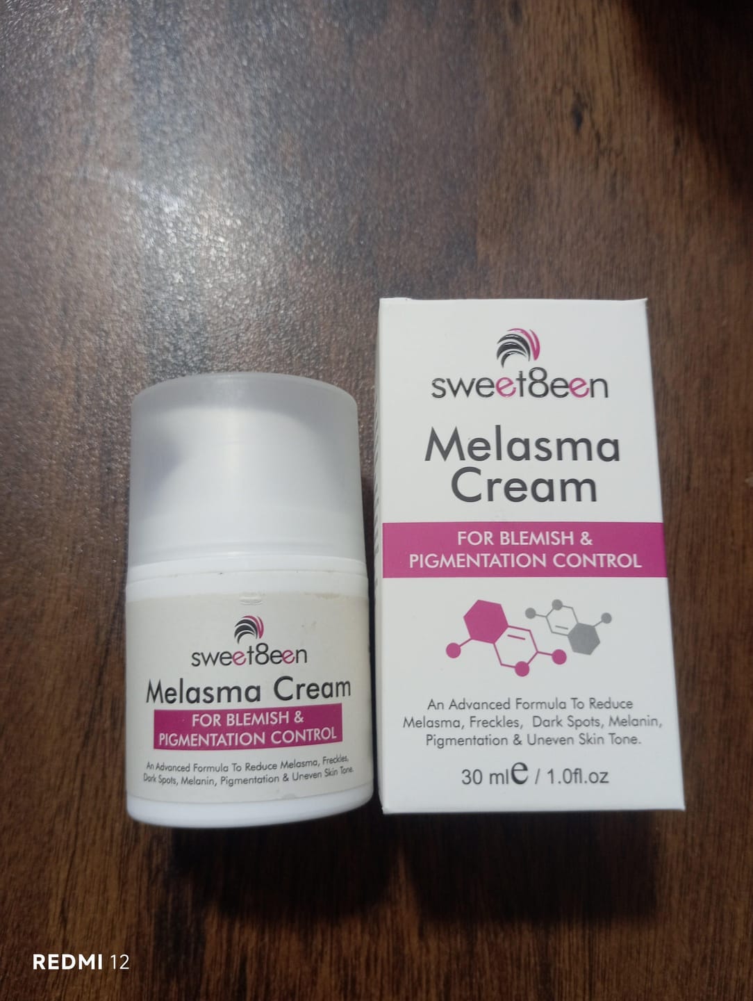 Customer photo review of Melasma Cream