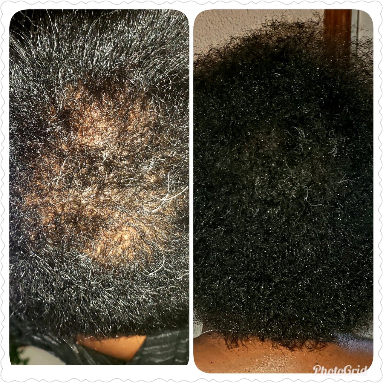 Customer photo review of Avocado Oil Stimulating Hair Growth Serum