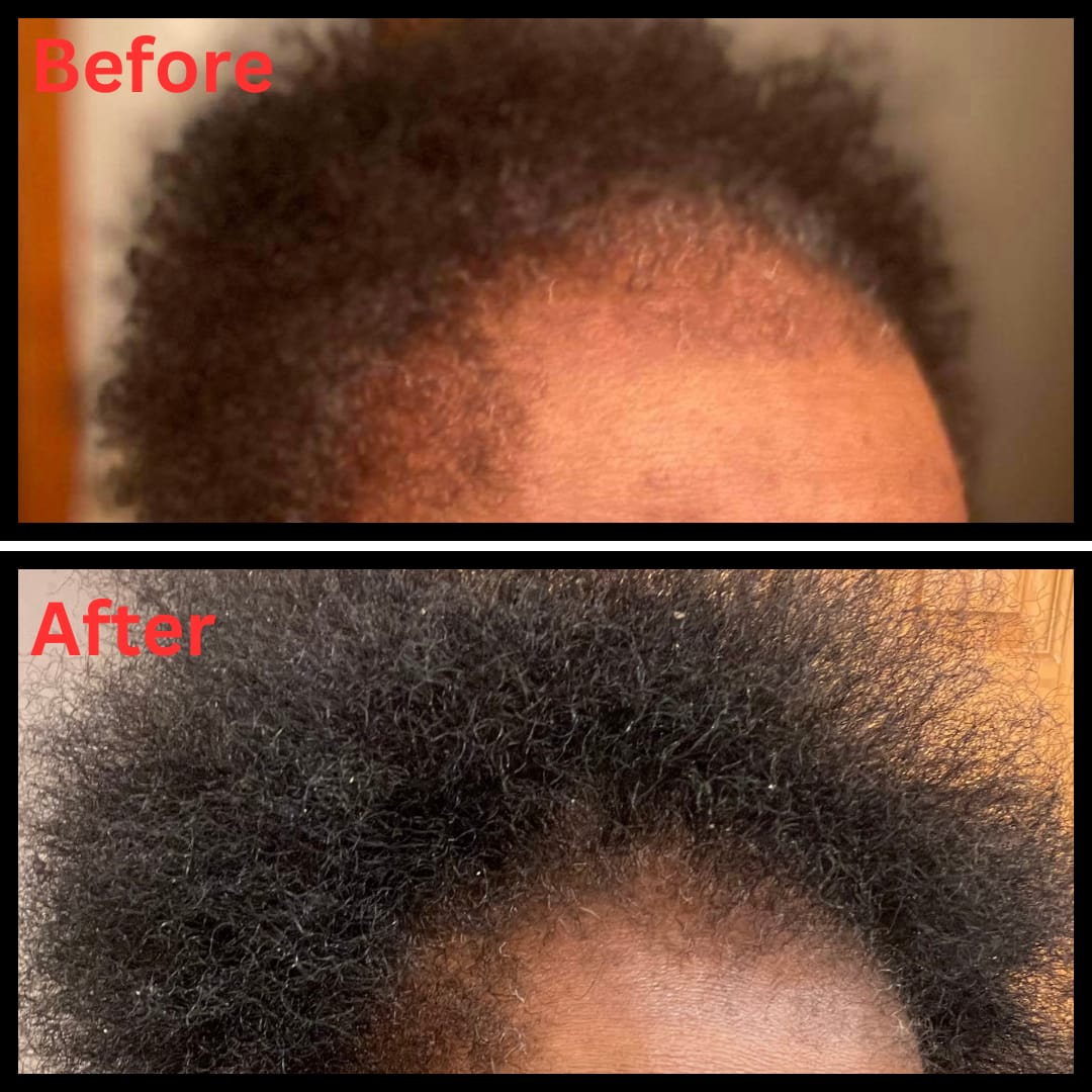 Customer photo review of Avocado Oil Stimulating Hair Growth Serum