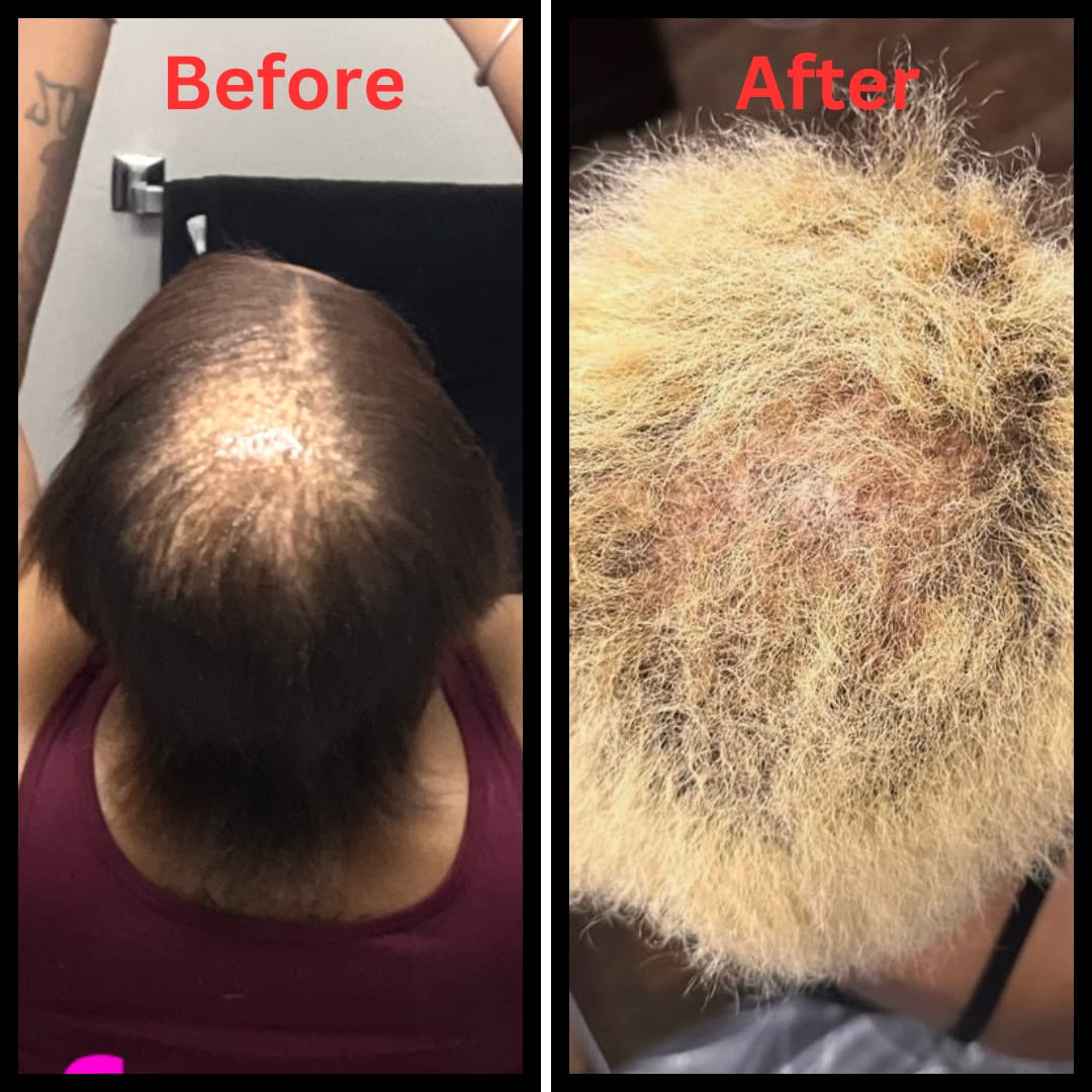 Customer photo review of Avocado Oil Stimulating Hair Growth Serum