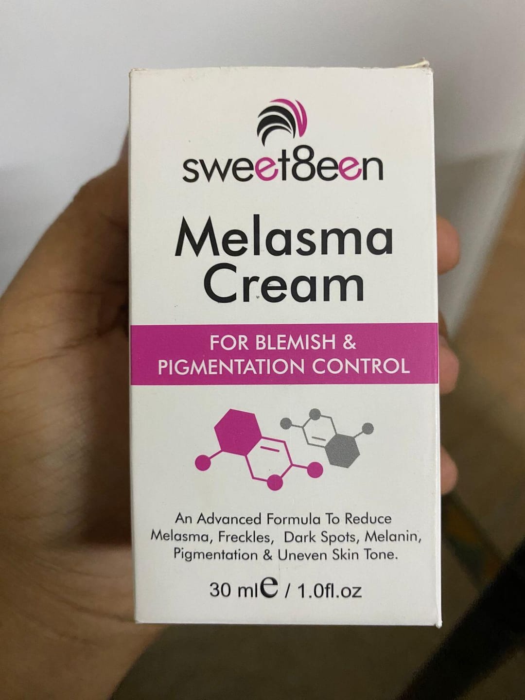 Customer photo review of Melasma Cream
