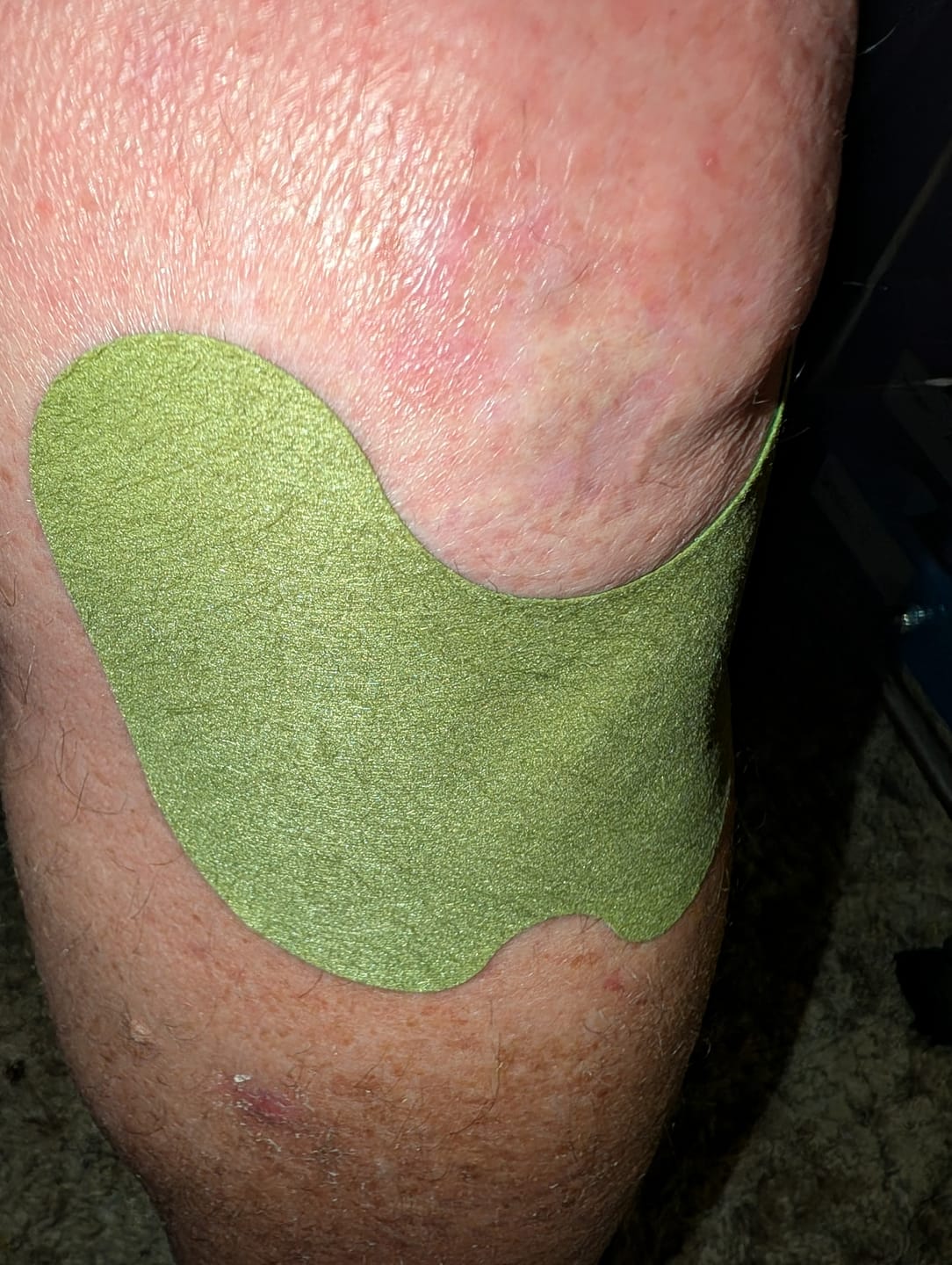 Customer photo review of Natural Herbal Knee Patches